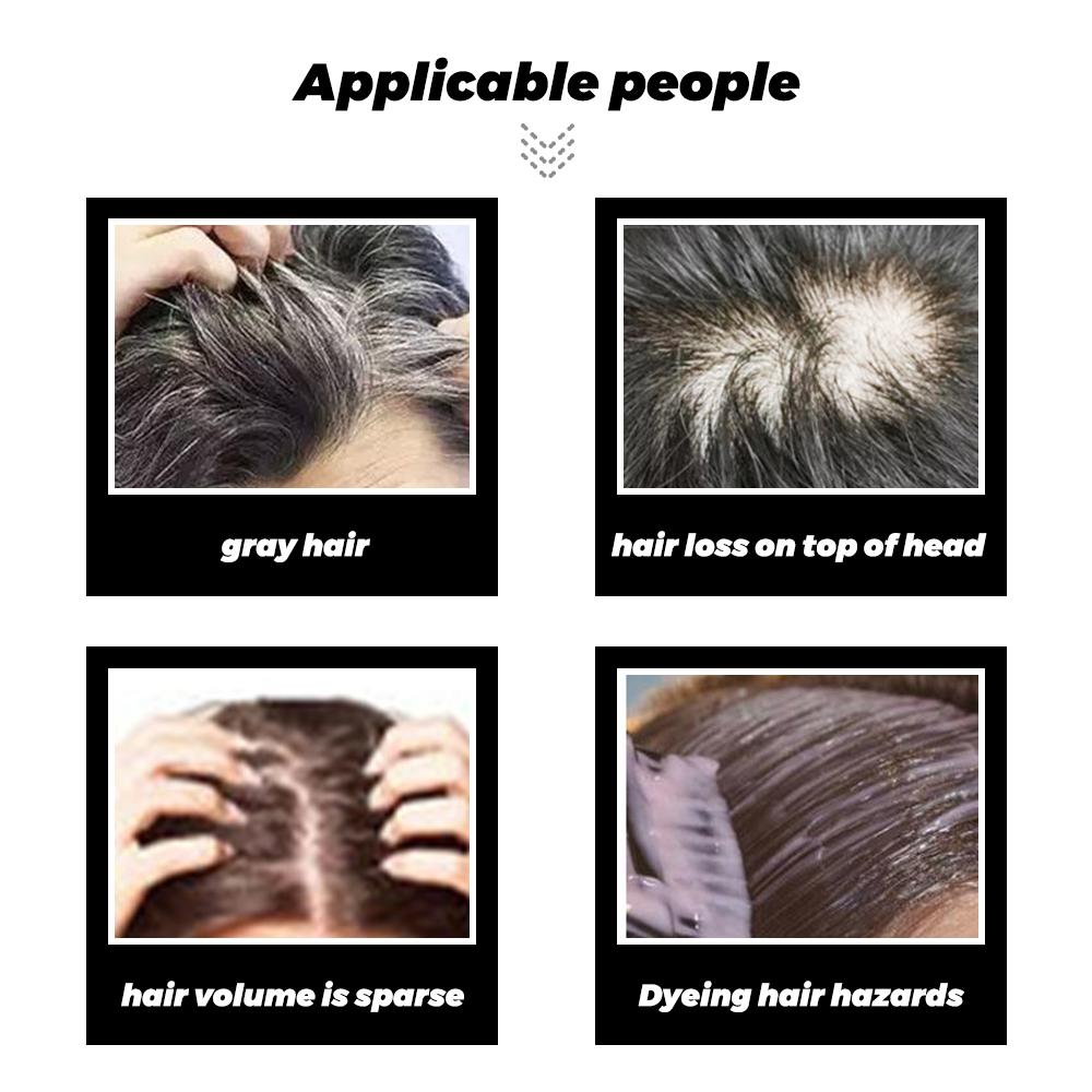 Wig Female Fluffy and Traceless Cover White Light Thin Short Curly Hair Invisible Hair Replacement Block