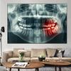 Abstract Dental Teeth X-Ray Dentist Canvas Painting Health Medicine Posters and Prints Wall Art Pictures Home Decor No Frame