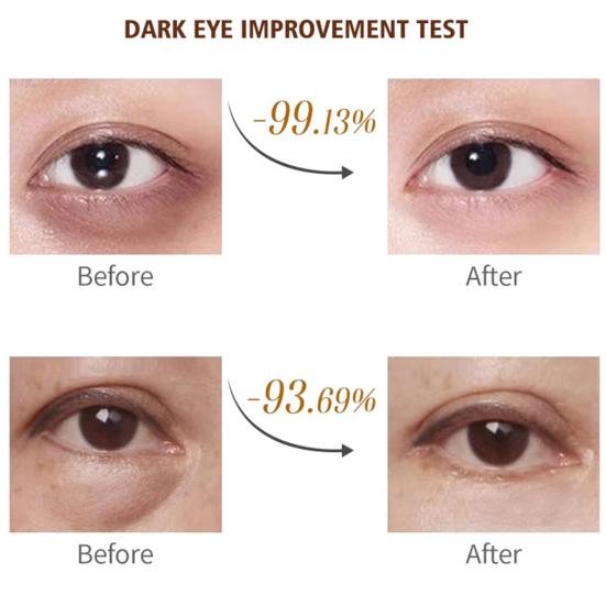 Ретиноловый карандаш для глаз, дружественный к коже, простой в использовании, нежный, эффективный, антивозрастной, осветляющий бальзам для глаз