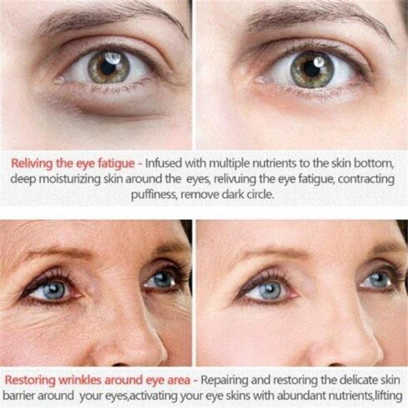 Water Light Needle Eye Cream Увлажняющий крем для кожи вокруг глаз для удаления мешков под глазами Dark Circle Fat Granule Collagen Eye Cream