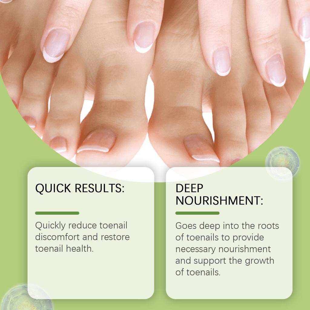 Toenail Fungus TreatmentExtra Strong, NailTreatment, Nail Care TreatmentExtra Strong For Thick, Discolored And Damaged Nails,30ml