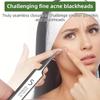 Набор инструментов для лечения акне из нержавеющей стали, игла для лечения акне, черные точки, акне и выдавливание акне, выдавливание акне и выдавливание акне.