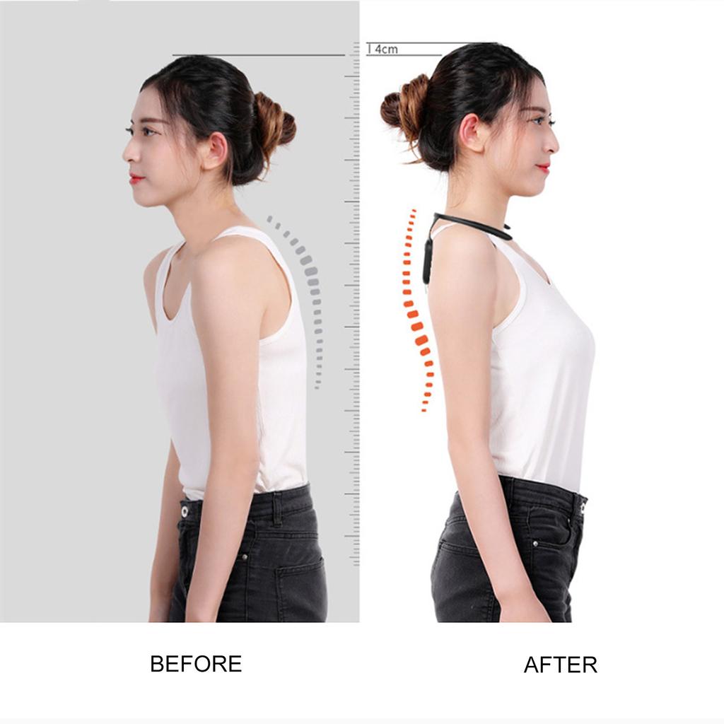 Adult Children's Intelligent Hunchback Corrector Male and Female Correction Belt Hunchback