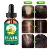 Anti Hair Loss Moisturizing and Softening Care Solution, Long Hair Thickening and Growth Solution