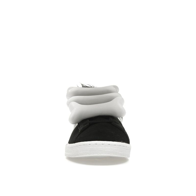Jeremy Scott x adidas Campus 80s Bones - Черные Унисекс Кроссовки Core-Black Footwear-White HQ4493