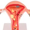 1 шт., медицинский реквизит, модель патологической матки, яичников, анатомическая модель, инструмент для изучения поперечного сечения анатомии