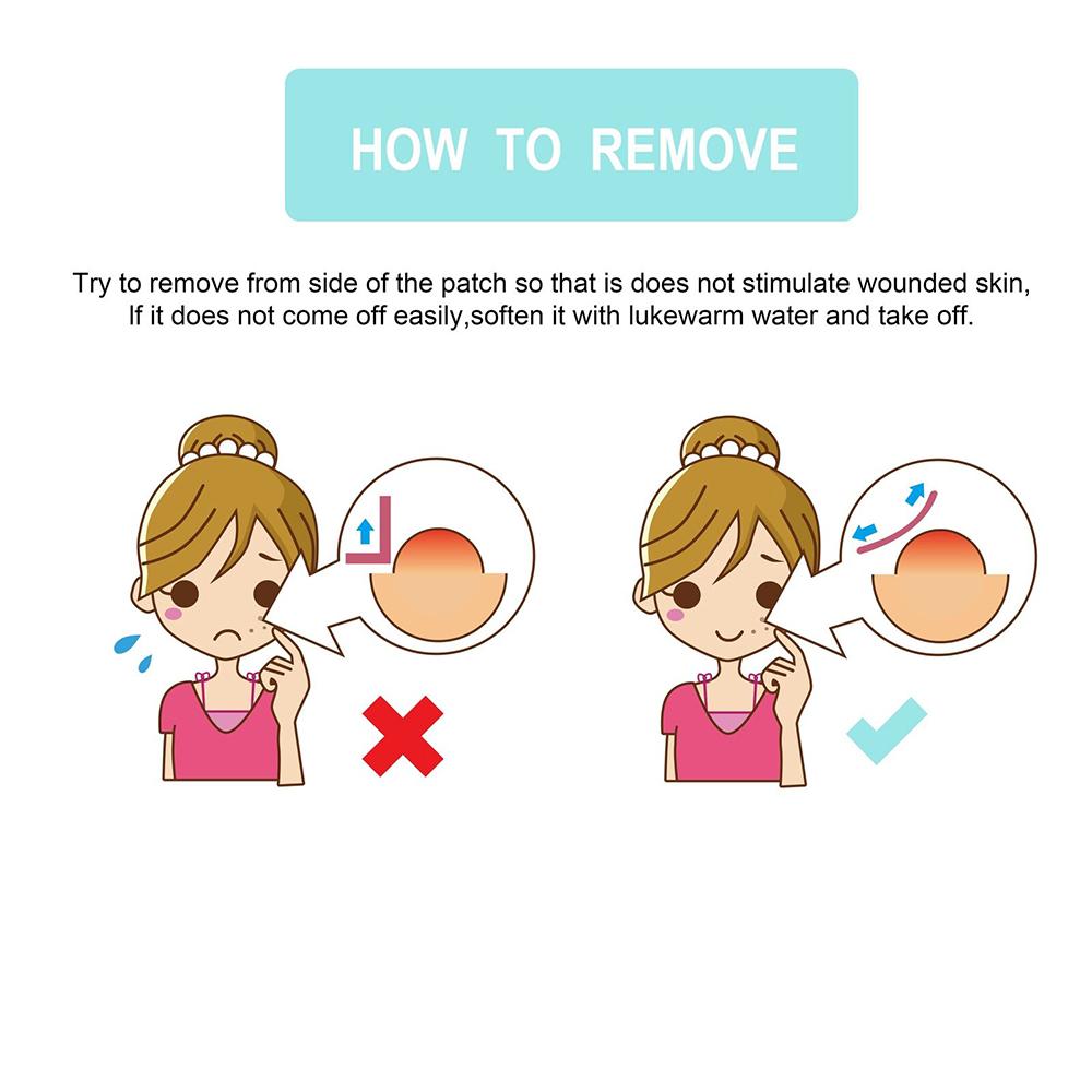 72 шт., лечебные пластыри от прыщей и прыщей, невидимые наклейки для ухода за пятнами на лице