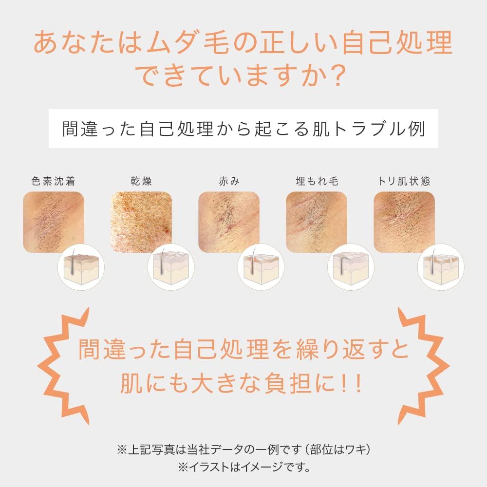 TBC Hikari Beauty 4 PRO Устройство для удаления волос с охлаждением Домашнее Световое Удаление Волос Световая Красота Нежелательные Волосы Нежелательные Волосы Бикини Эстетика TBC Функция, Использование,