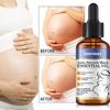Anti-Stretch Mark Essential Oil-Provide Comfort And Relief To Stretched Skin-Keep Skin Soft And Supple, 30ml