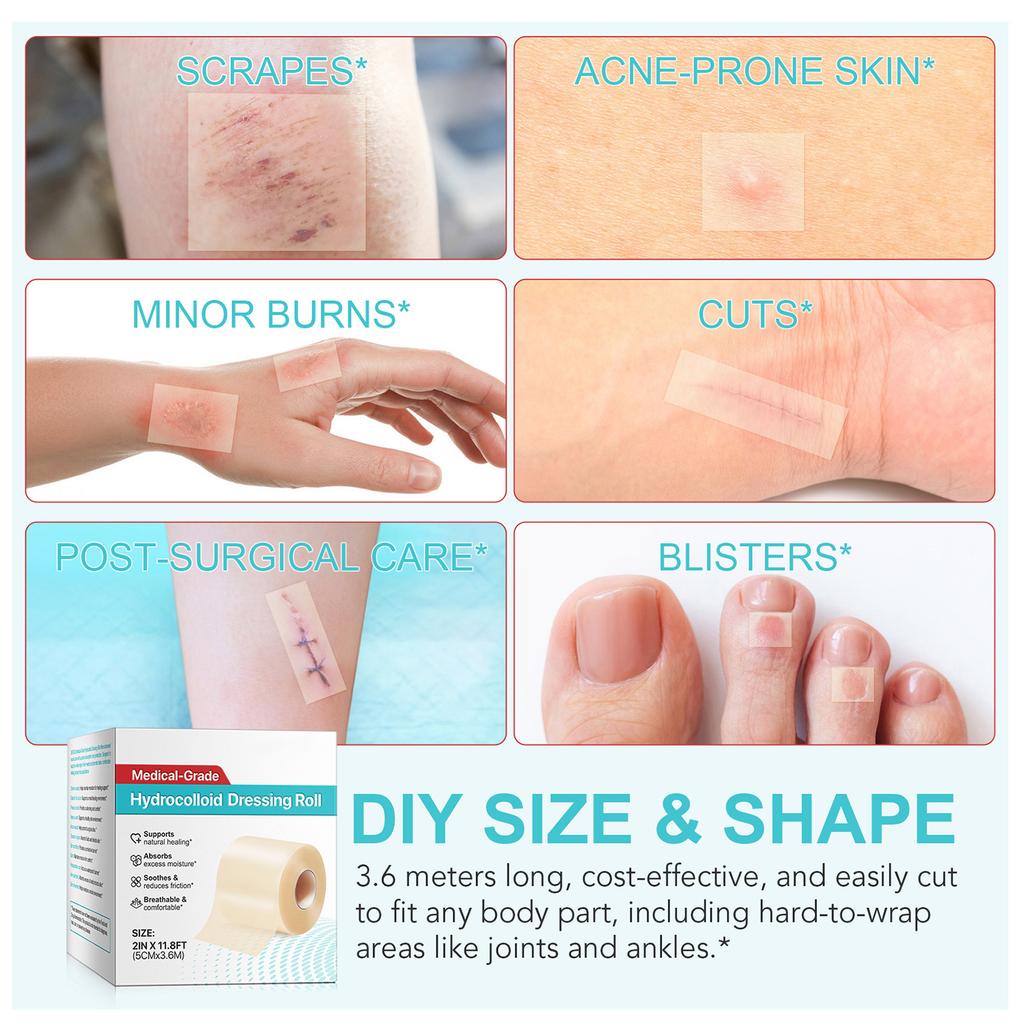 ГИДРОКОЛЛОИДНАЯ ПОДКЛАДКА-РУЛОН Подушечки для поврежденной кожи Патч для ухода за кожей, Кожный пластырь Удобный дышащий материал Удобный дизайн Для путешествий и домашнего использования