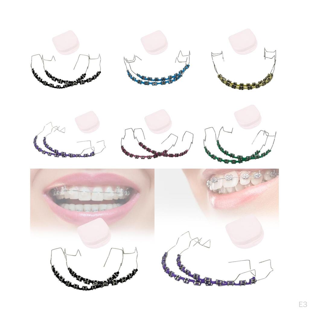 Временное украшение для зубов, практическое применение, металлические скобки для студентов