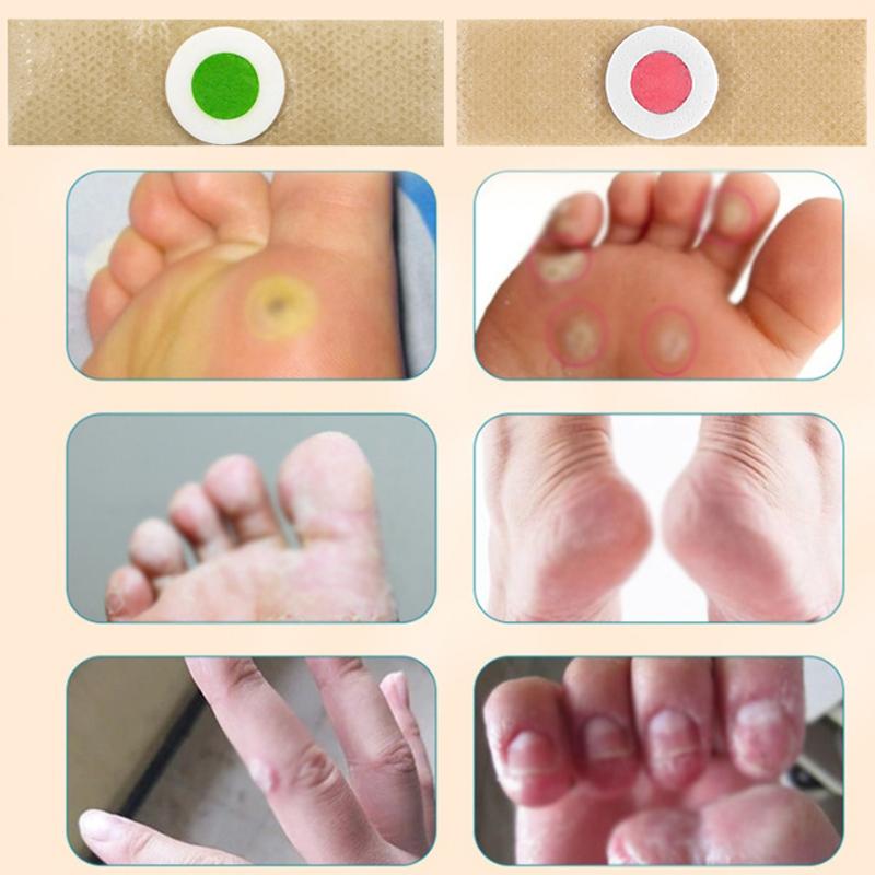6/12/18/24/30/36 шт. Пластырь для удаления мозолей и натоптышей на ногах, подушечки для мозолей, пластыри, аксессуары для обуви, средства для ухода за ногами