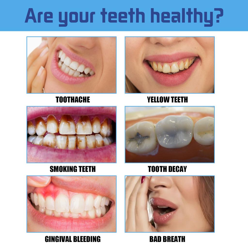 EELHOE Зубная паста-мусс, отбеливание зубов, мусс, пена для глубокой чистки, зубная паста, удаляет пятна, свежее дыхание, инструменты для ухода за зубами, 60 мл