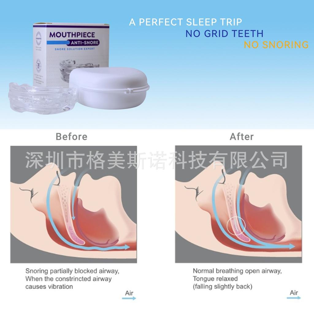 Adjustable Anti Snoring Mouthpiece, Stop Snoring Device, Snore Guard, Anti Snore Mouth Guard for Adults, Snoring Solution