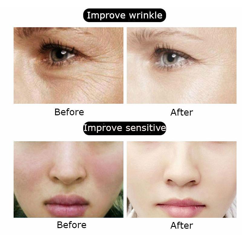 Natural Silk Protein Collagen Essence Ball Use With Lotion Or Toner Skin Care Moisturizing Nourish 5pcs