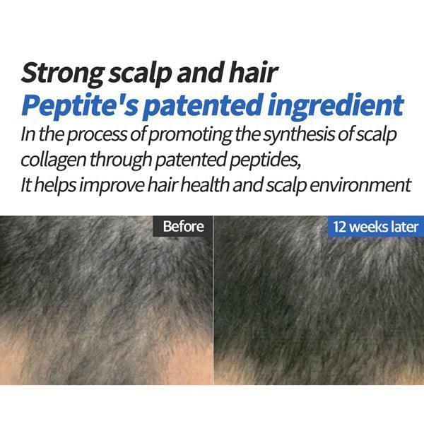 [COSNORI] 8GROW Anti-Hairloss Pro Vitamin B5 Hair Tonic 100ml