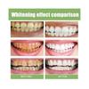 Ampoule Toothpaste,ampoule Tooth Serum, Ampoule Essence Toothpaste,fruit Acid Teeth Whitening Essence (1box/10pcs)