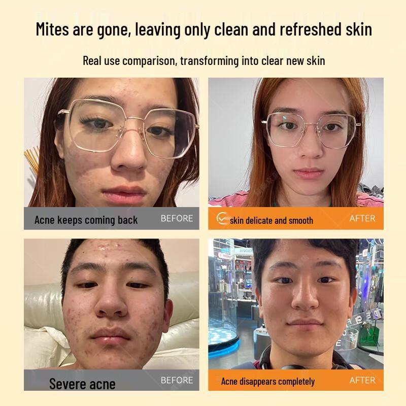 Sulfur Purifying Facial Cleanser