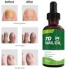 30ml Toenail Fungus , 7 Day Toenail Fungus , 7 Plant Extracts, Suitable For Athlete's Foot, Thick Nails, Broken Nails, Discolo