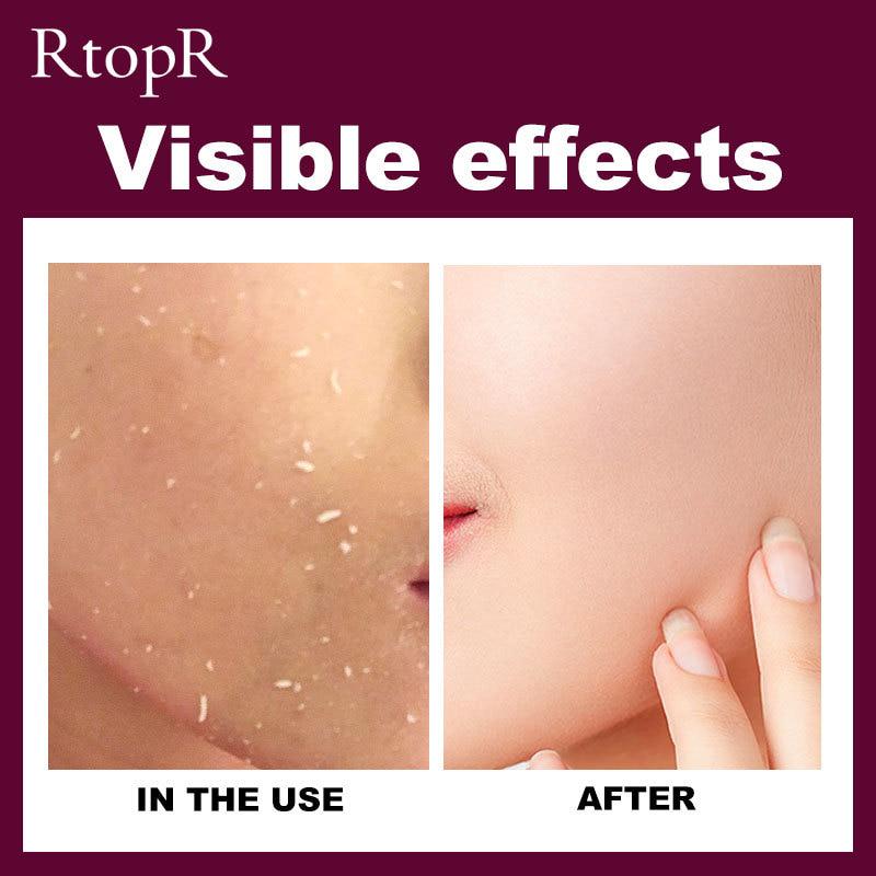 Очищающий пилинг-гель для лица с манго 40г