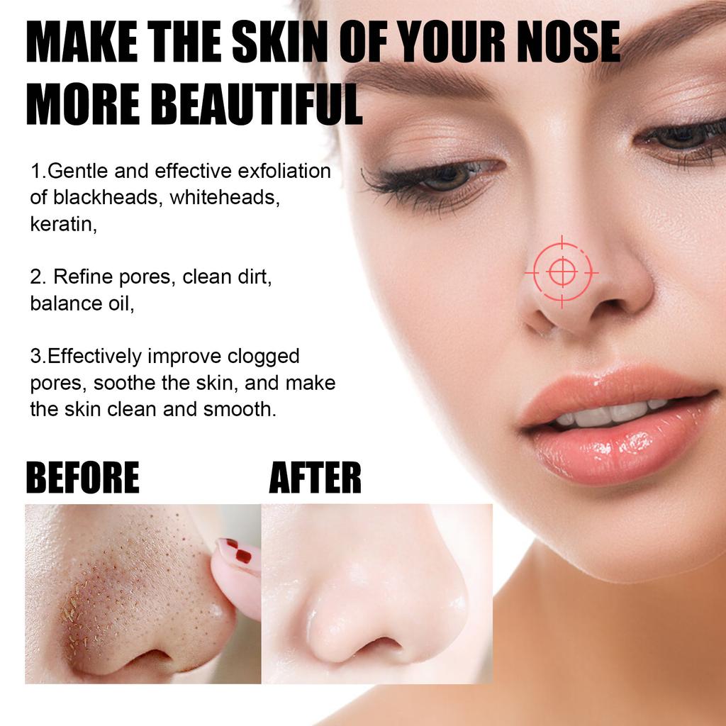 15 г + 40 шт., чтобы удалить угри и подтянуть маску для носа, глубоко очистить и сузить поры угрей, прыщей и подтянуть маску для носа