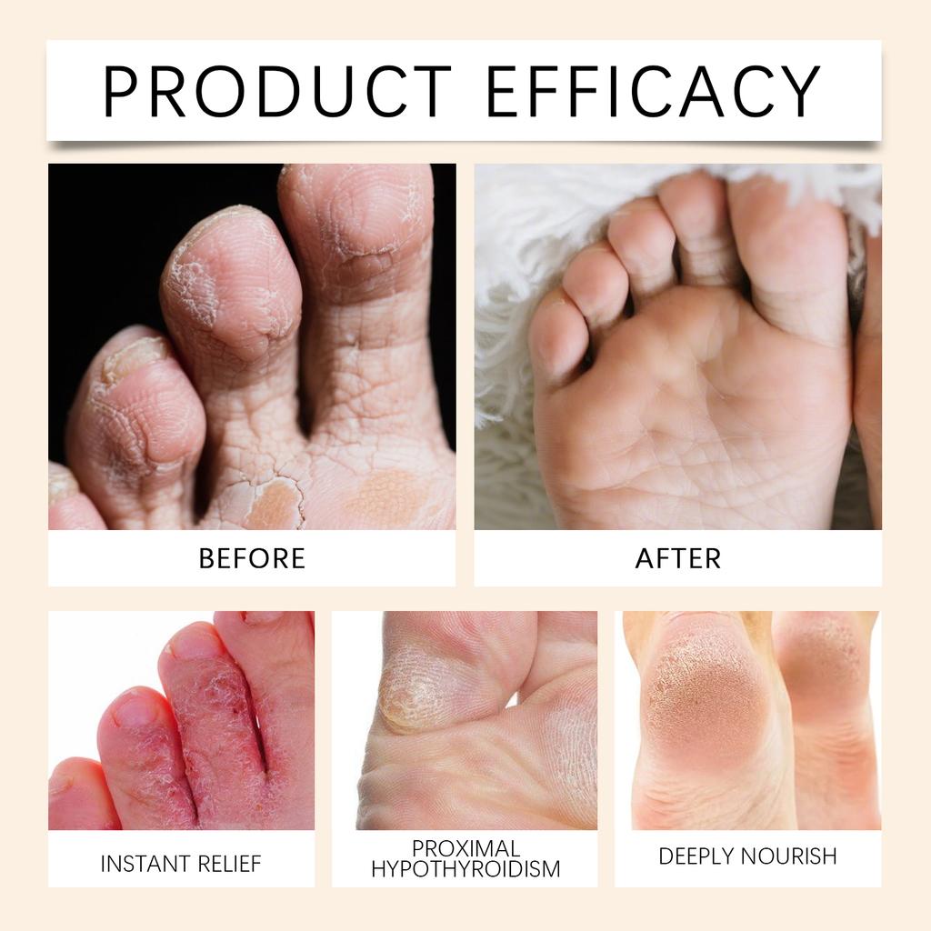 Крем для успокоения ног легкий, нежирный, быстро впитывается, снимает усталость, увлажняет сухость и подходит для ежедневного ухода.