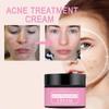 Remove Acne Mild Repair Acne Pits Acne Marks Nourishing Moisturizing Hydrating Acne Cream