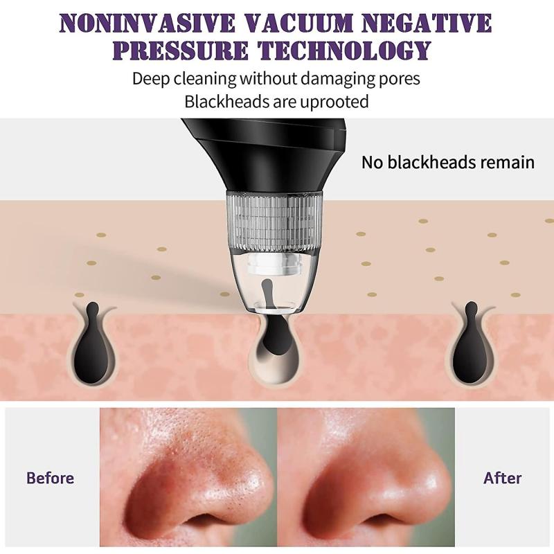 Blackhead Remover Pore Cleaner Blackhead Removal Skin Care Tool