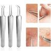 3 Piece Blackhead Removal Clip8.7cm, Stainless Steel Beveled Acne Clip, Cotton Tweezers, Beauty Acne Needle, Easily Remove Tiny Acne, Remove Acne Blac