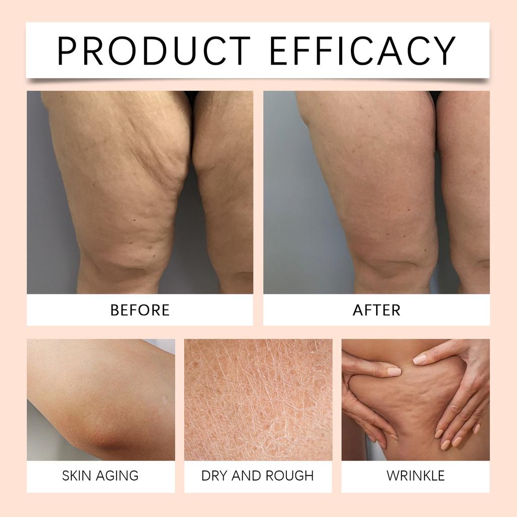 Wrinkle Face Cream For Extremely Dry Skin For Itchy Skin And Puffiness 100g