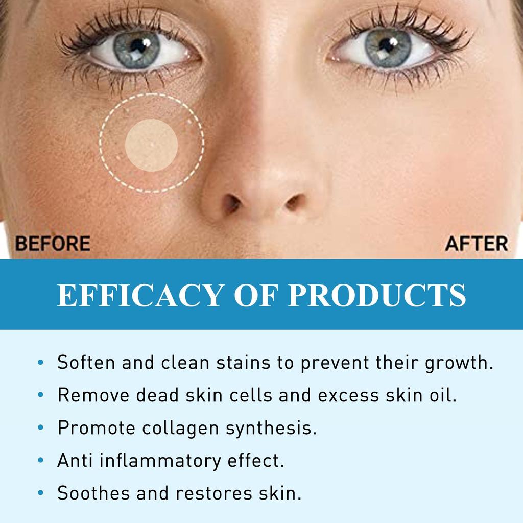 Пластырь с жировыми гранулами, удаление гранул масла с лица, подкожных комков, плоский пластырь для восстановления гранул потовой трубки