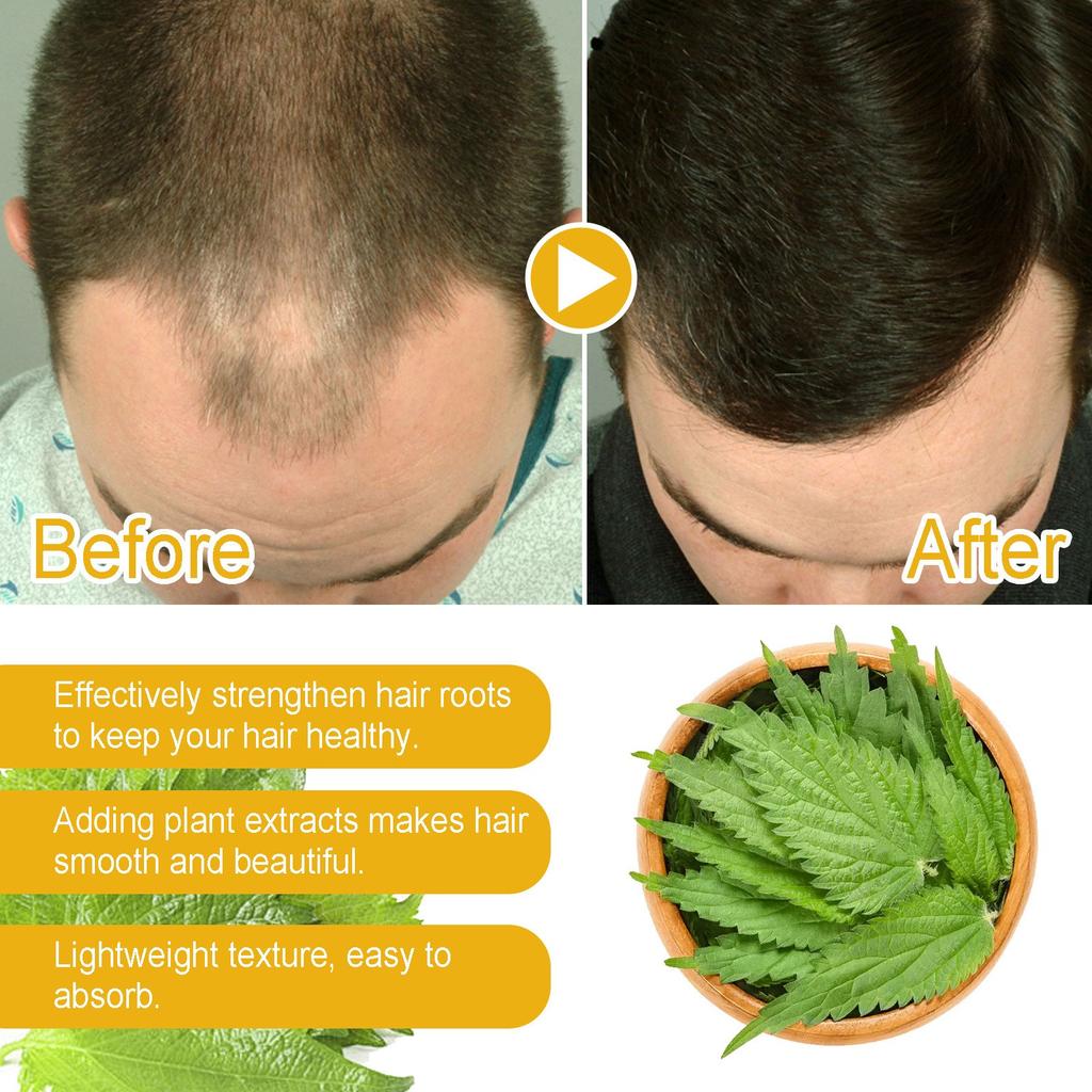 Deep Cleansing Scalp Moisturizing Renovate Solid Hair Dense Anti-fall Smoothing Hair Care Shampoo