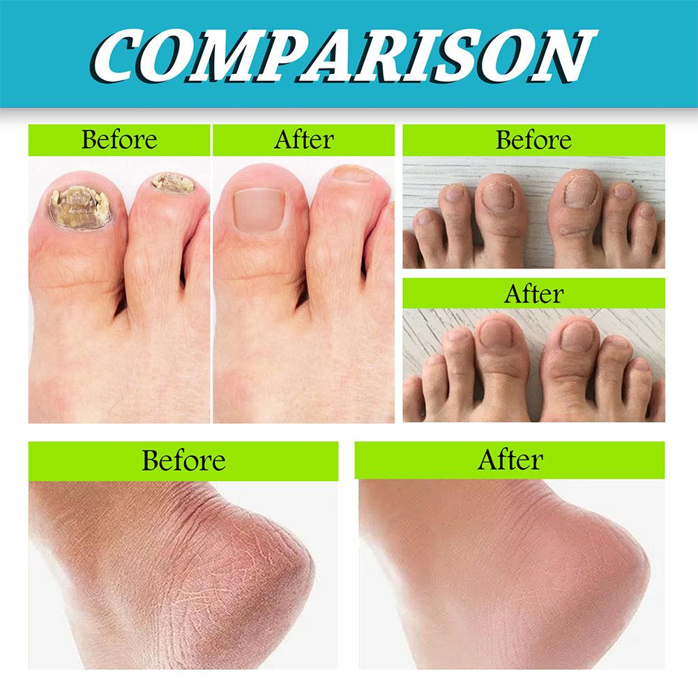 Foot Shoe Odor Deodorant Spray Perfume Scent Odor Removal Anti-Sweat Formula Eliminates Bad Smell for Feet Footwear Socks Gentle