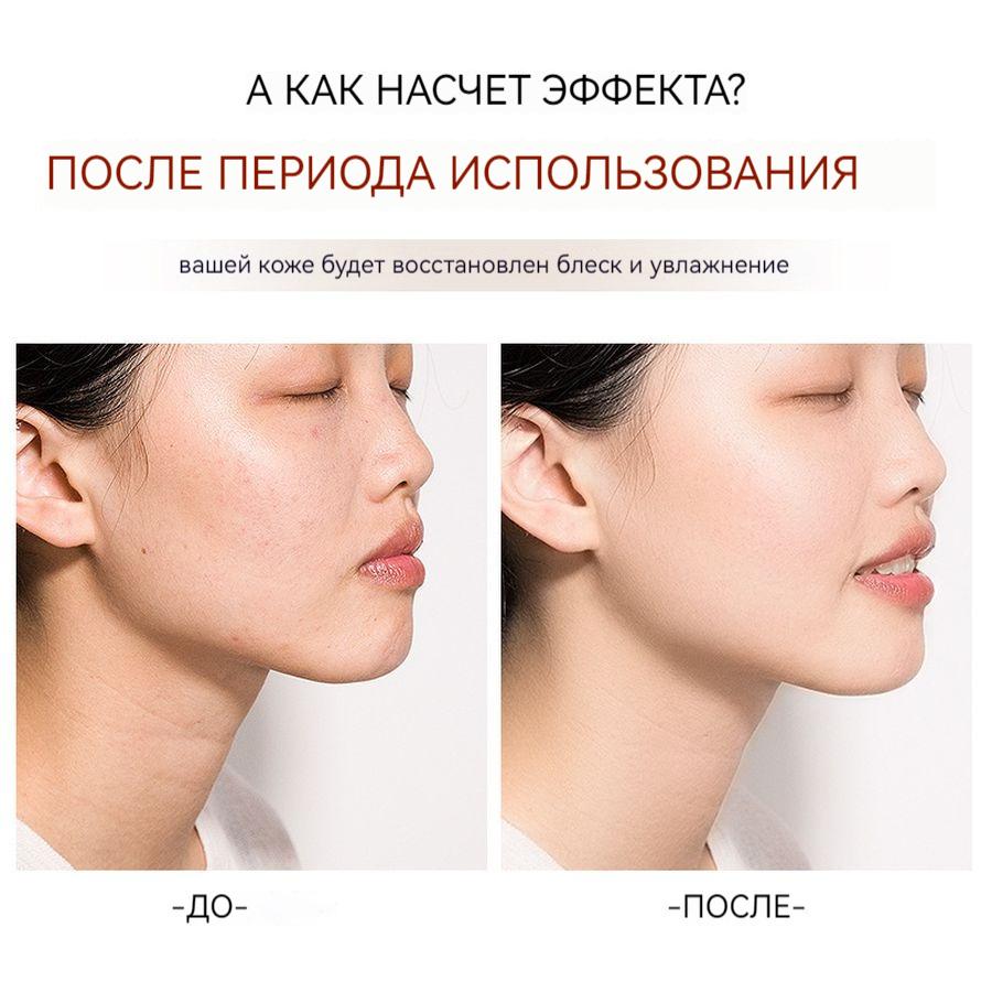 35г Увлажняющий ланолиновый крем-лосьон для ухода за кожей, восстанавливающий, крем с гиалуроновой кислотой