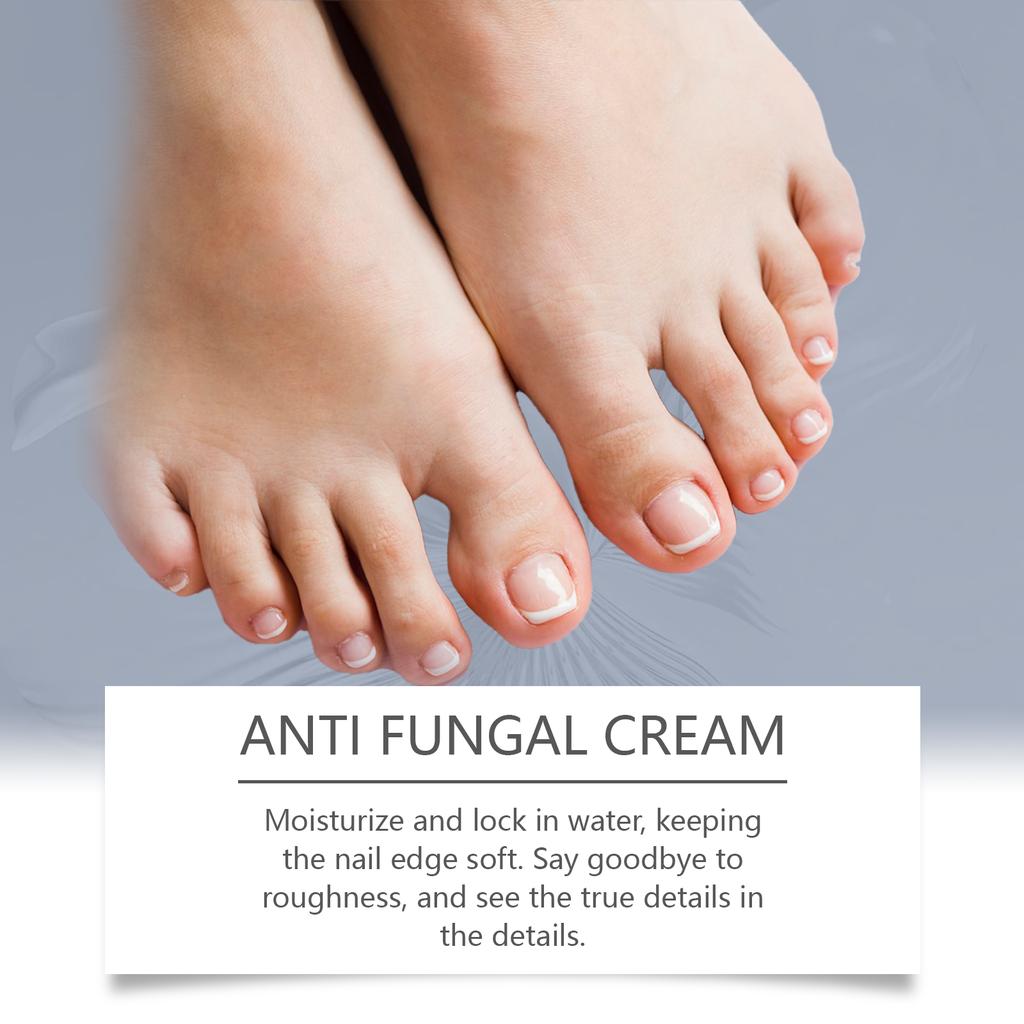 Крем для лечения онихомикоза Bright Nails Thick Nails Уход за пальцами ног Onychomycosis Soothing Nail Care Cream