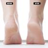 Crack Heel Repair Socks, Moisturizing Open Toe Socks For Dry Feet, Easy To Use During Rest Or Sleep, Flexible Cotton Blend Ensures Comfort And Fit,