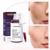 AHA 30%+BHA 2% Red Glycolic Peeling Serum Pore Reduction Blackhead Acne Removal Pore Cleaning Oil Control Whitening Essence, 30ml, 1 Piece
