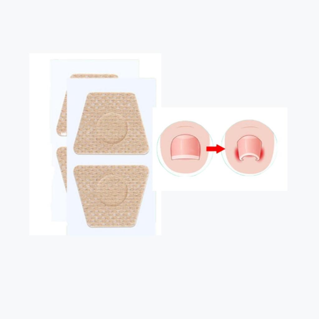 10 шт. пластырей для лечения грибка ногтей, восстановление и улучшение внешнего вида поврежденных, обесцвеченных и толстых ногтей, инструменты для удаления грибка ногтей на ногах
