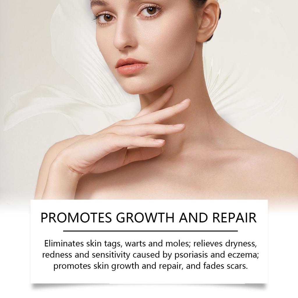 Универсальный крем для ухода за кожей, успокаивающий крем для кожи, устраняет папилломы и родинки; Устраняет сухость, чувствительность, вызванную экземой, 1 шт, 50 г