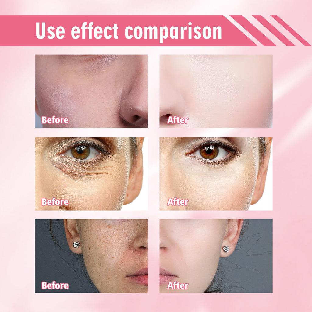 Removing And Whitening Serum Moisturizing Serum Facial Care Serum Removing And Fine-line-lightening Serum,15ML