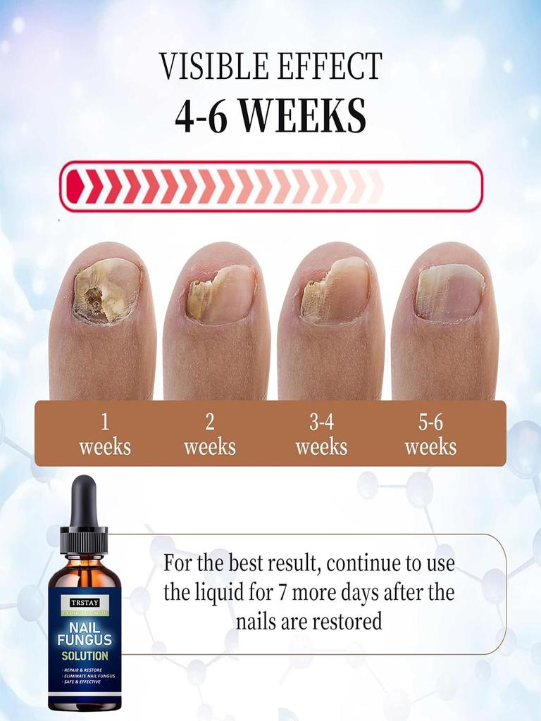 5 мл/15 мл/30 мл/50 мл/Crazylife Hand And Foot Nail Onycho Repair Nail Onychomycetant для утолщения ногтей, подавитель