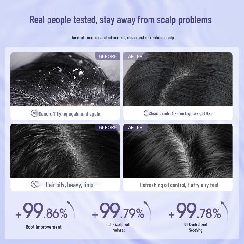 Шампунь против перхоти с дисульфидом селена и набор геля для душа с двойными кислотами