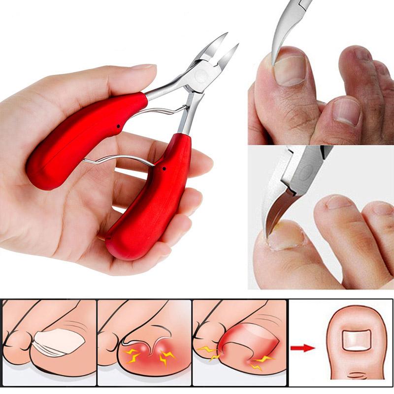 1 шт., кусачки для ногтей на ногах, коррекция ногтей, кусачки для ногтей, фрезы, инструмент для удаления омертвевшей кожи, инструмент для ухода за педикюром