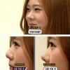 Beauty Nose Clip Corrector Massage Tool Nose Up Lifting Shaping Clip Clipper Shaper Bridge Straightening No Pain 3 Size