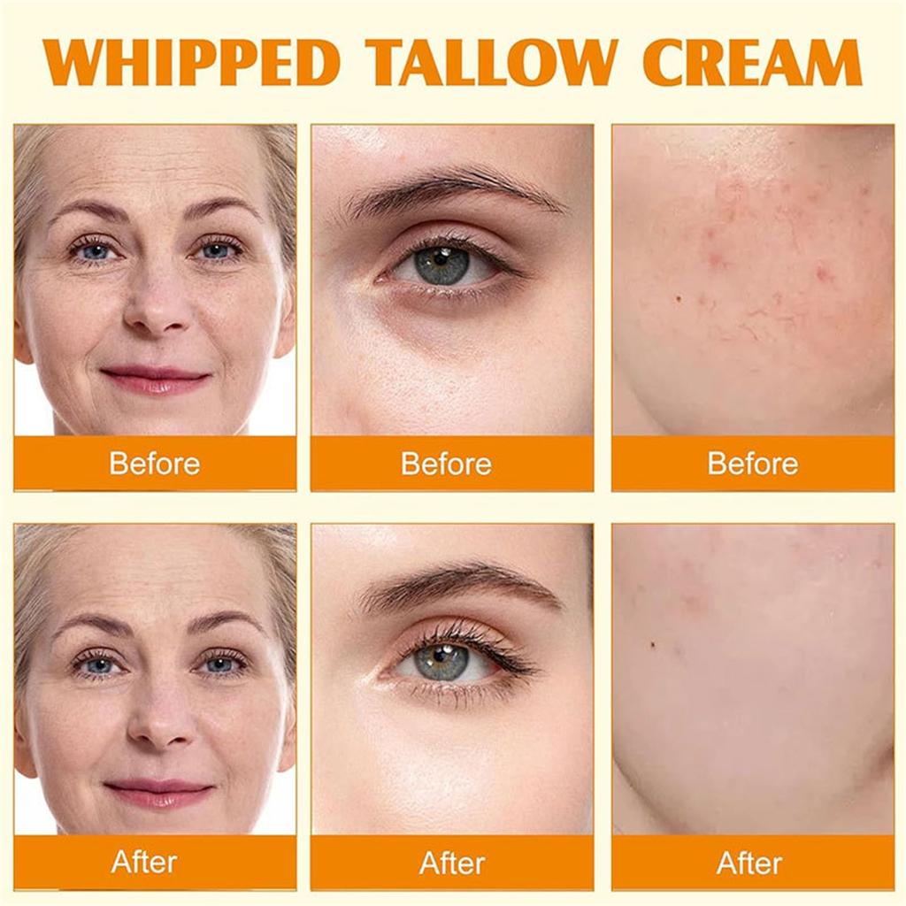 Увлажняющий крем для кожи Увлажняет и успокаивает сухую кожу Увлажняющий крем