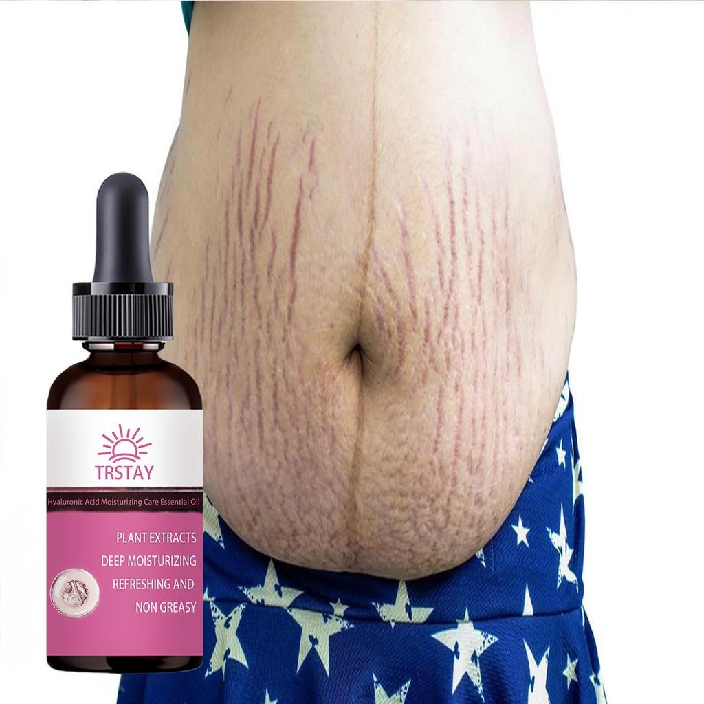 Pregnant Women Repair Belly Lines, Postpartum Repair Cream, Prevention Body Cream, Moisturize Skin , Remove Pregnancy Lines, Fat Lines, Face Cream