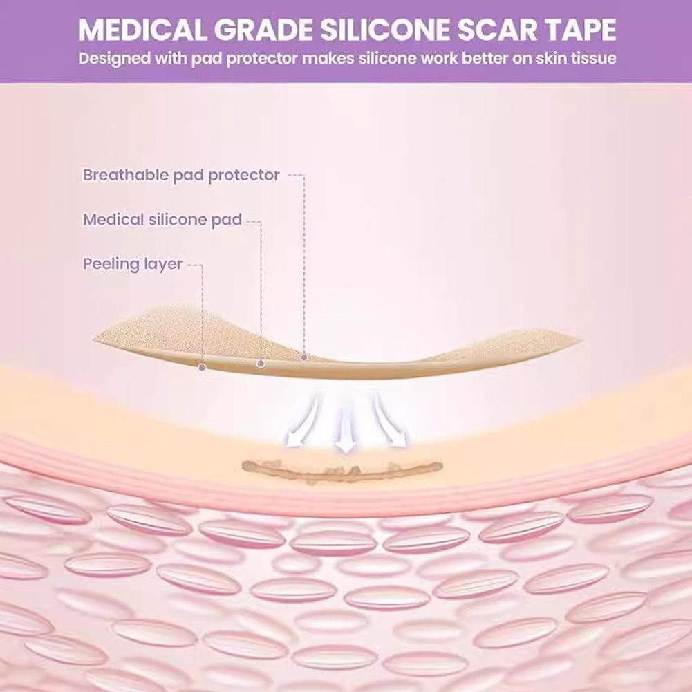 Силиконовый пластырь для шрамов, силиконовая лента для шрамов, рулон, пластырь для шрамов, пластырь для лечения акне и ожогов, пластырь для ухода за кожей Re C9M4