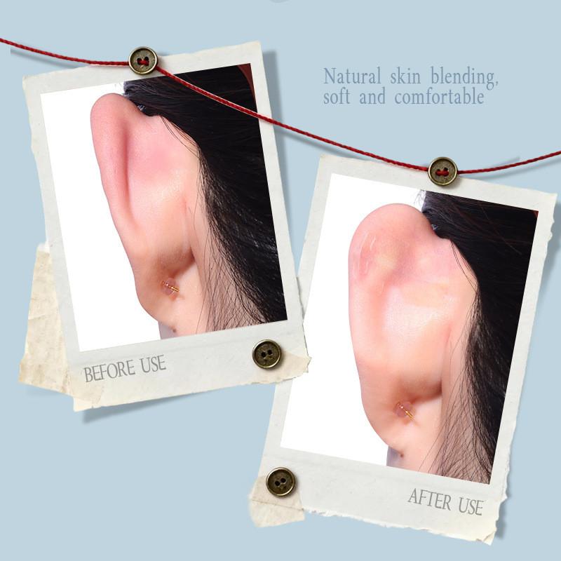 Invisible Dragon Bone Ear Lift Stickers 20Pcs Breathable Skin-Friendly Correction Patches for School Daily Casual Wear