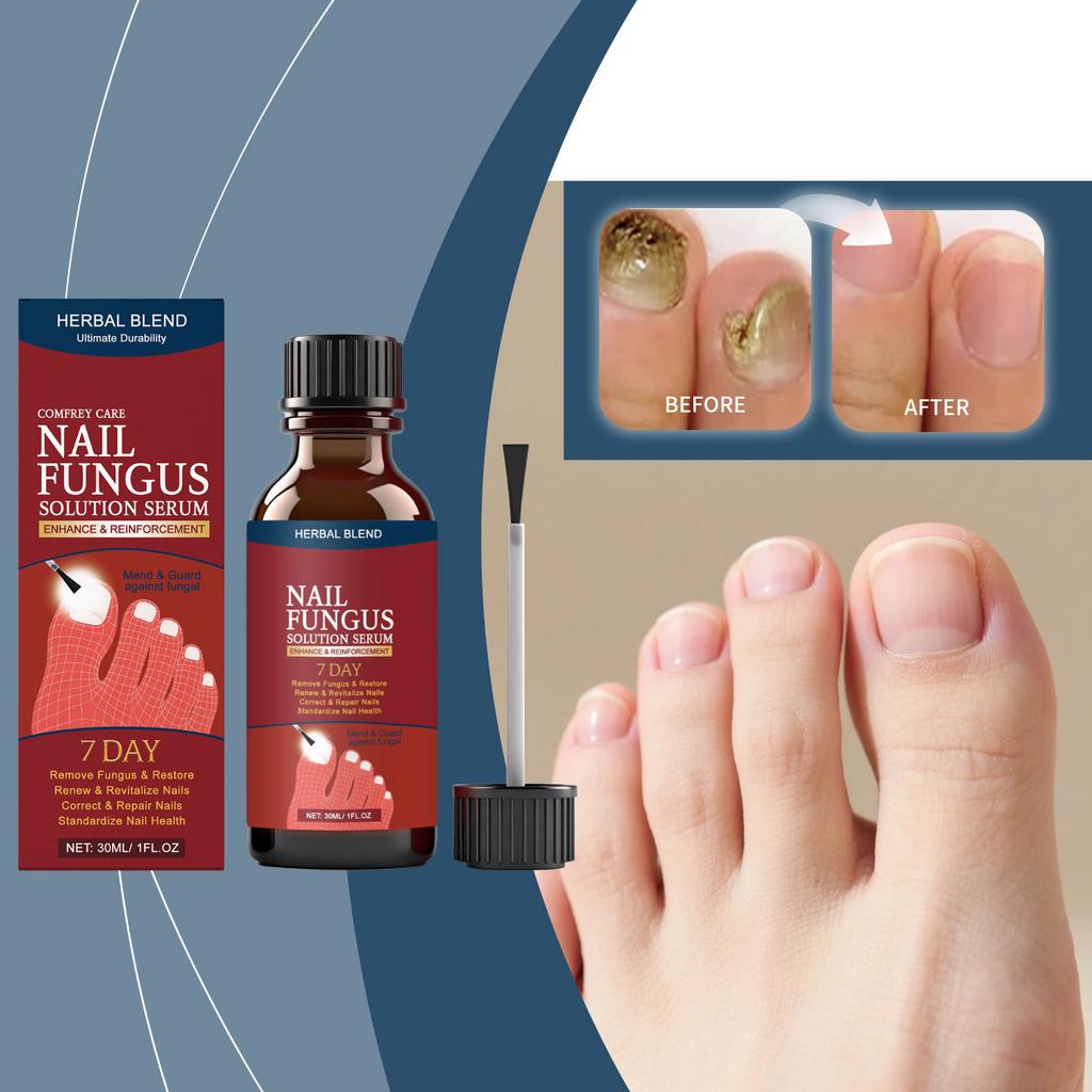 Nail Care Liquid Strengthens The Nail Bed, Toenail Care, And Strengthens The Growth Of Weak Nails,30ML