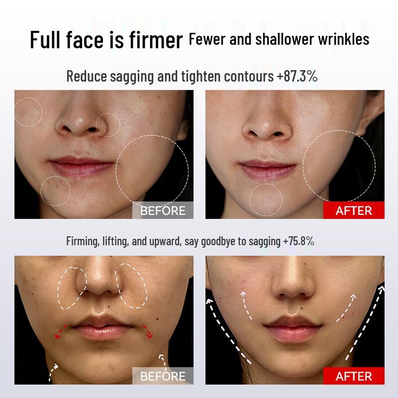 O'Selin Устройство для лифтинга лица V-Face Штепсель CN (адаптер в комплекте)